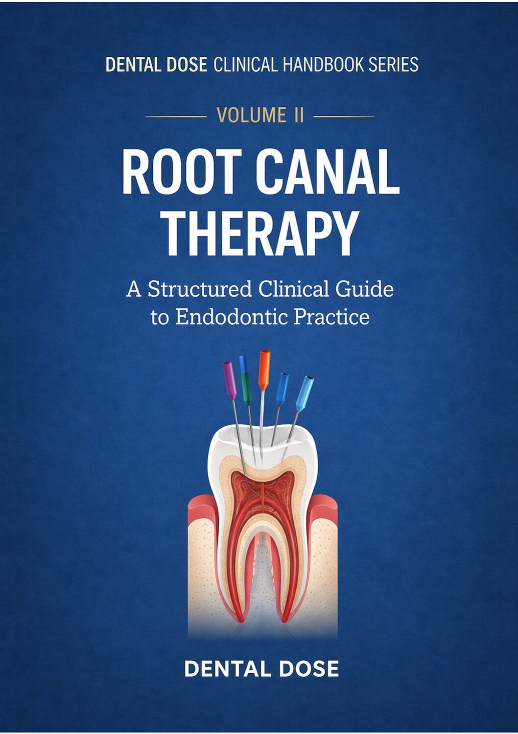 Dental Dose Clinical Handbook Series – Volume II: Root Canal Therapy